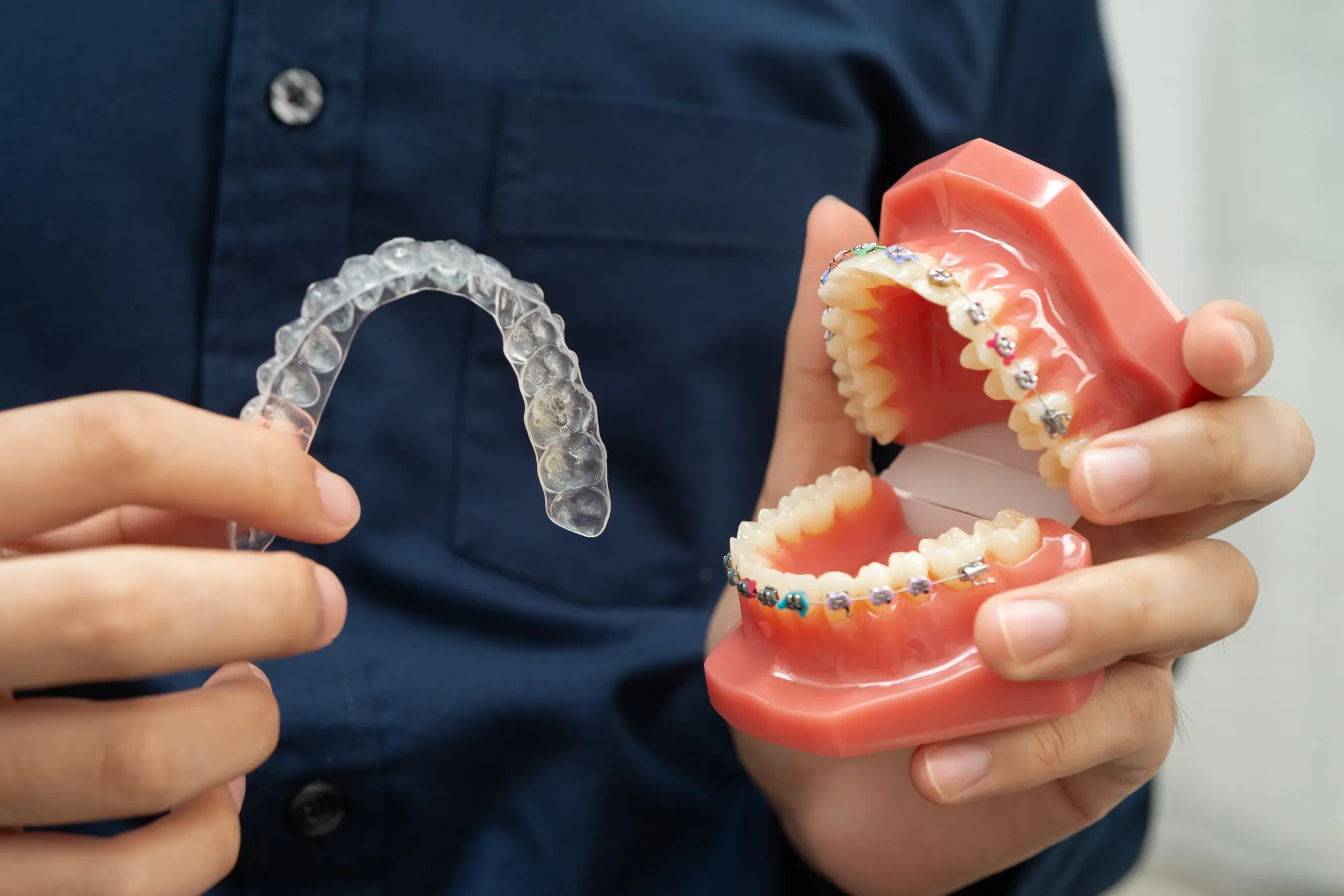 Hands holding a clear Invisalign aligner next to a model of teeth with traditional metal braces.