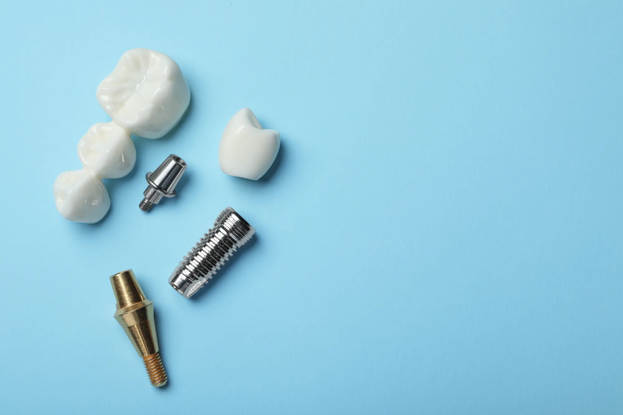 Dental bridge and implant components — a crown, abutment, and titanium screw — laid out on a blue background.