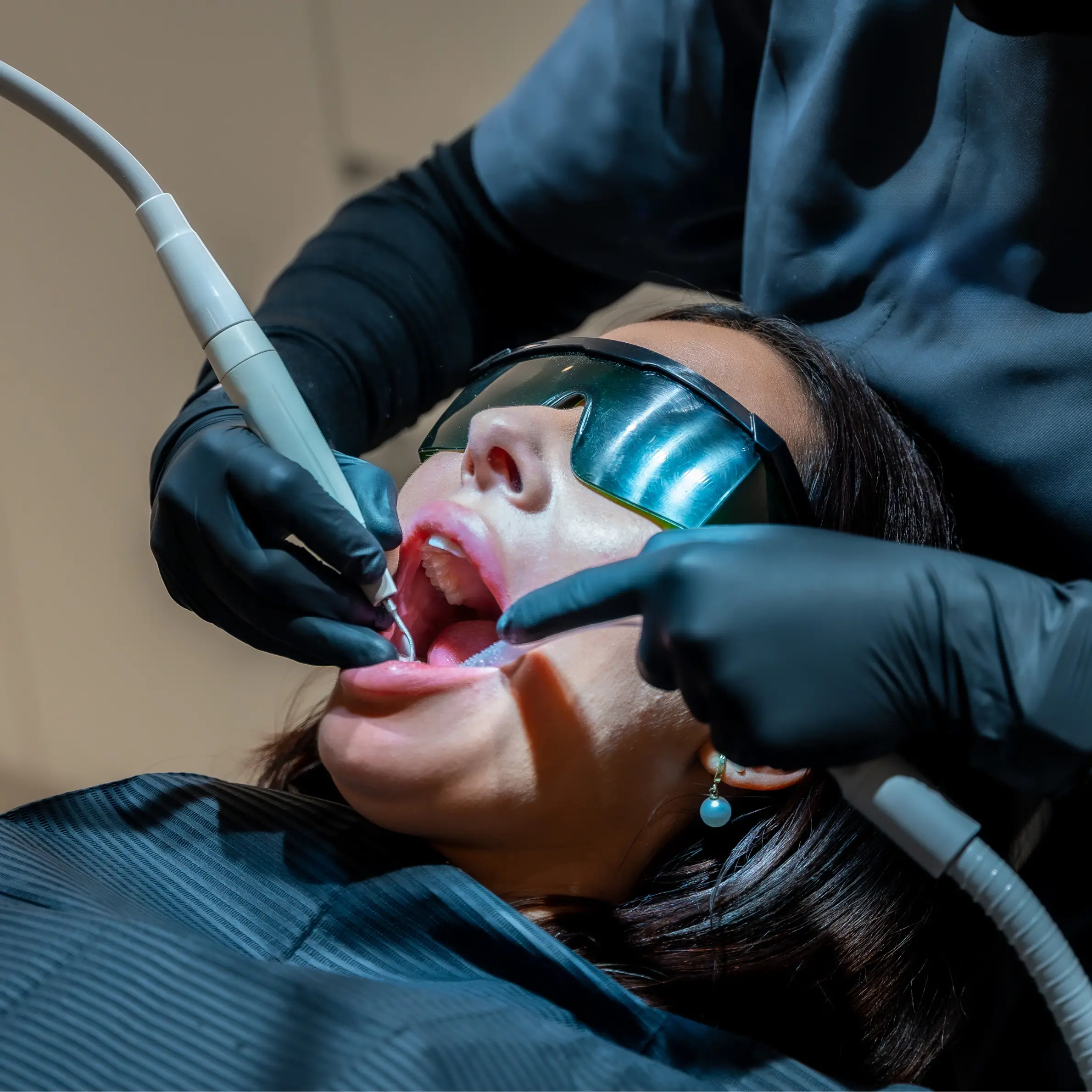 Bellingham Laser Bacterial Reduction (LBR) at The Local Dentist