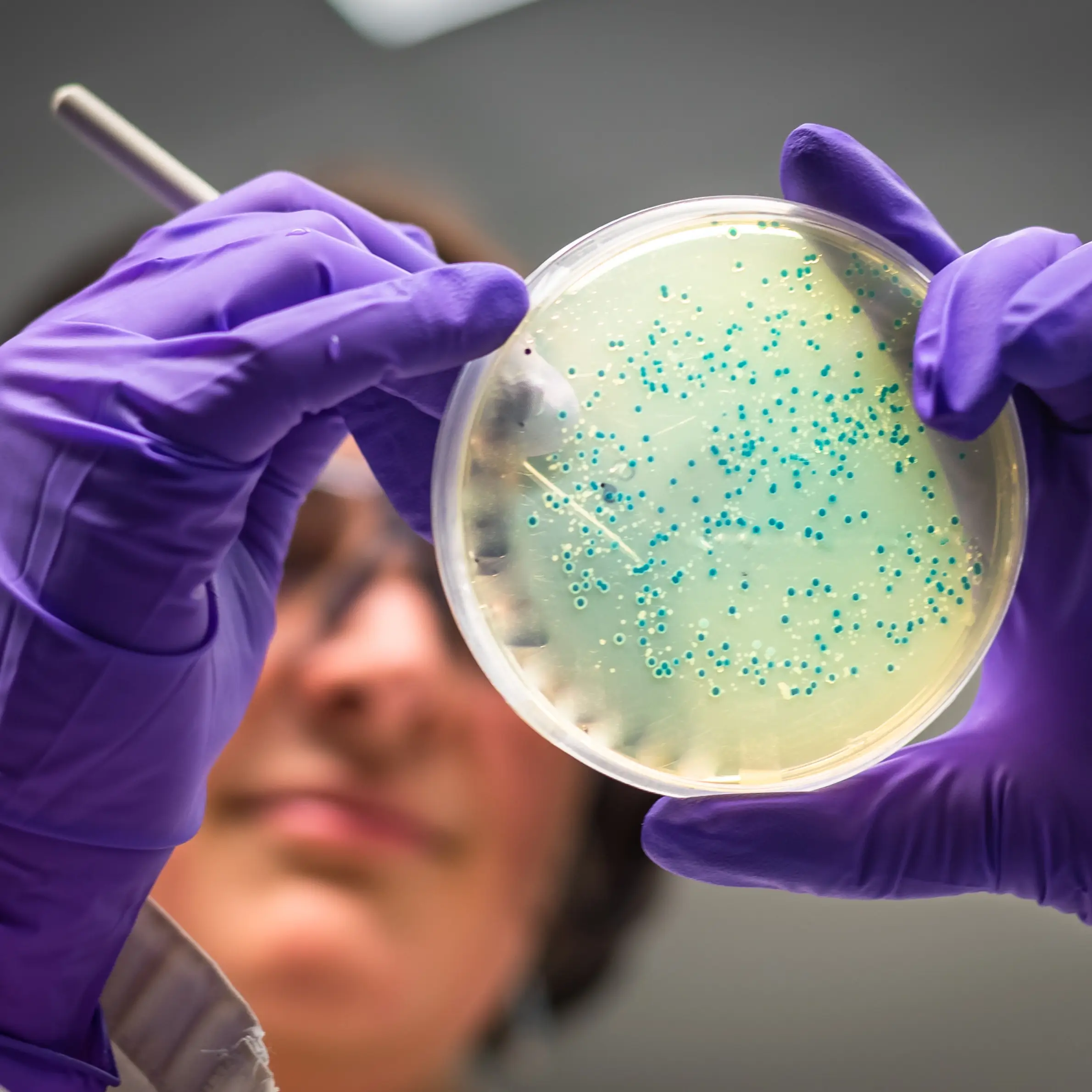 Bellingham Microbiome Testing at The Local Dentist