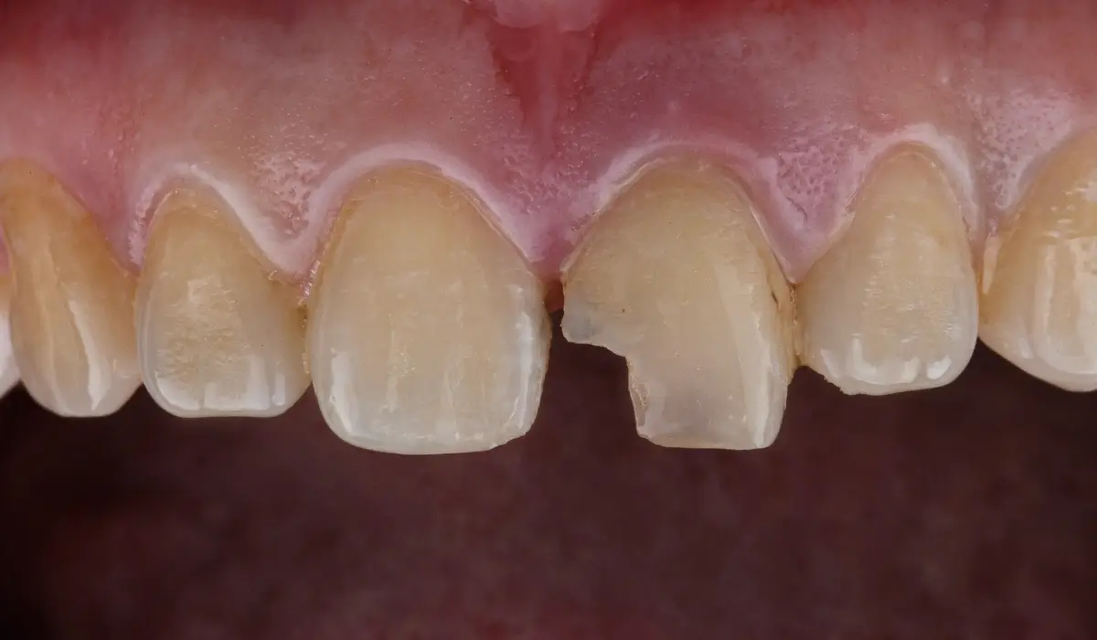 When to Call a Bellingham Urgent Dentist: A Quick Guide