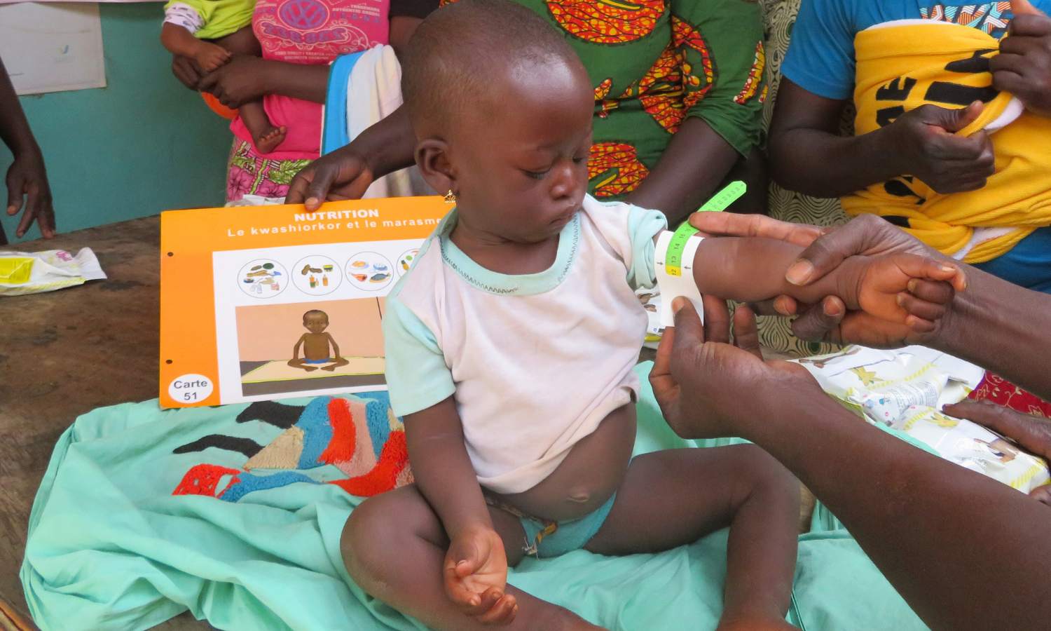 Ein Kleinkind in Burkina Faso wird mit einem MUAC-Band auf Mangelernährung untersucht. Die Szene zeigt eine Gesundheitsstation, wo die Ernährung von Kindern kontrolliert wird – Teil eines Projekts zu „Burkina Faso Nahrung für Kinder“.