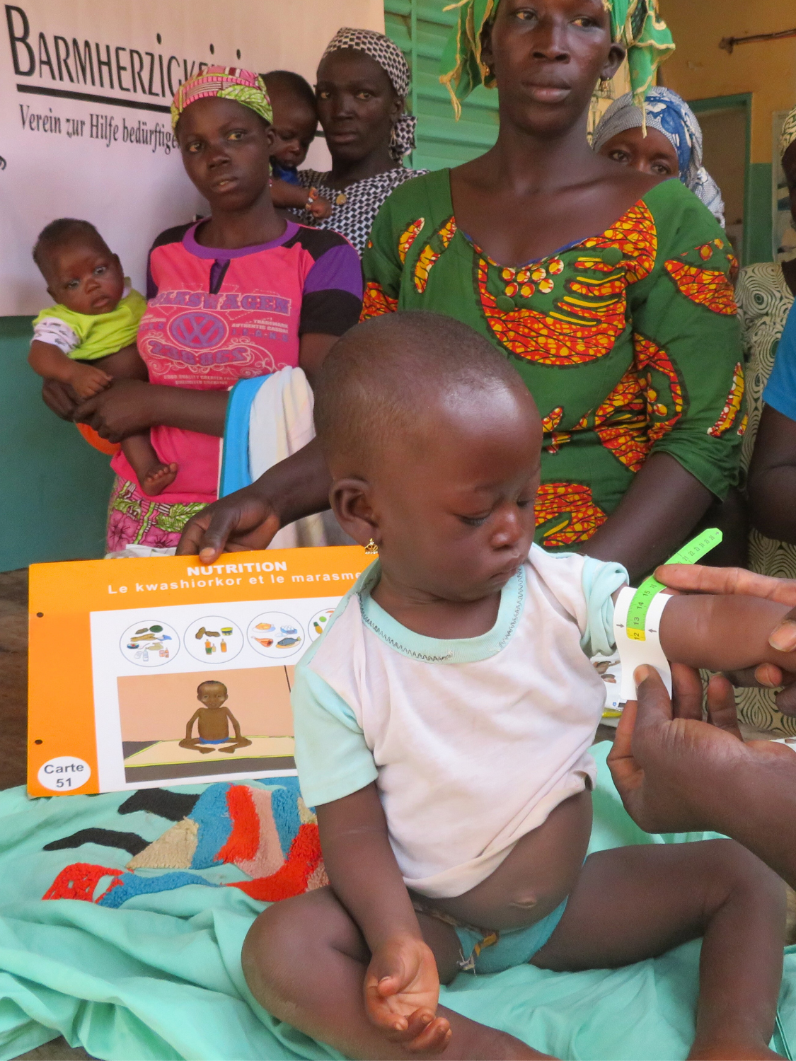 Ein Kleinkind in Burkina Faso wird mit einem MUAC-Band auf Mangelernährung untersucht. Die Szene zeigt eine Gesundheitsstation, wo die Ernährung von Kindern kontrolliert wird – Teil eines Projekts zu „Burkina Faso Nahrung für Kinder“.