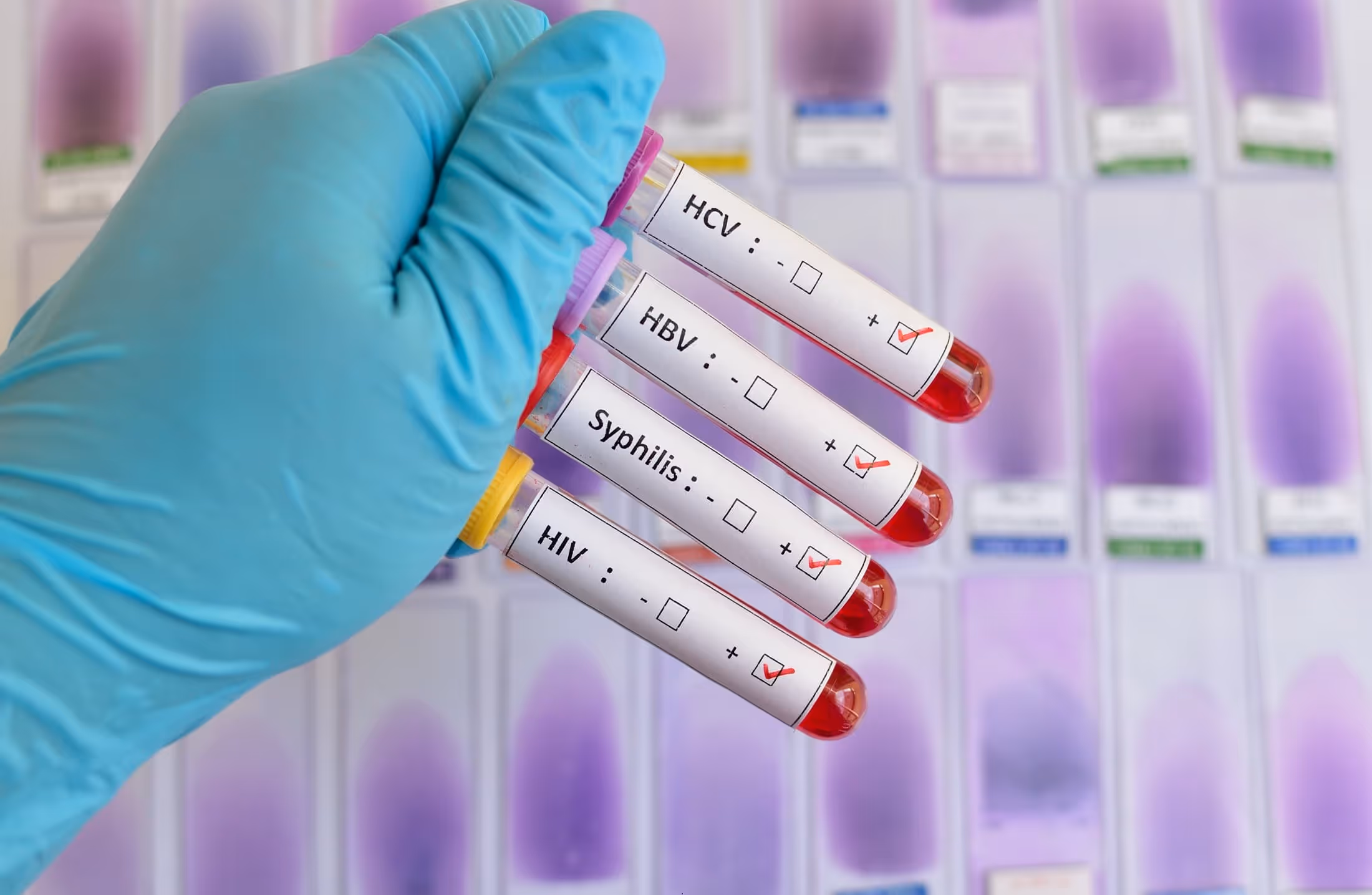 Carnaval com prevenção: 7 IST que mais crescem durante a folia