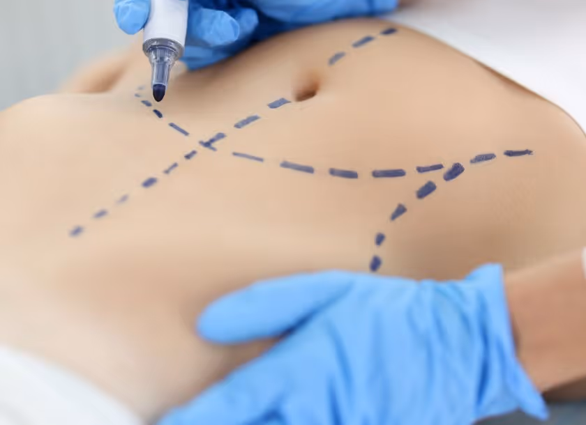 Conheça a história da cirurgia plástica no Brasil e no mundo