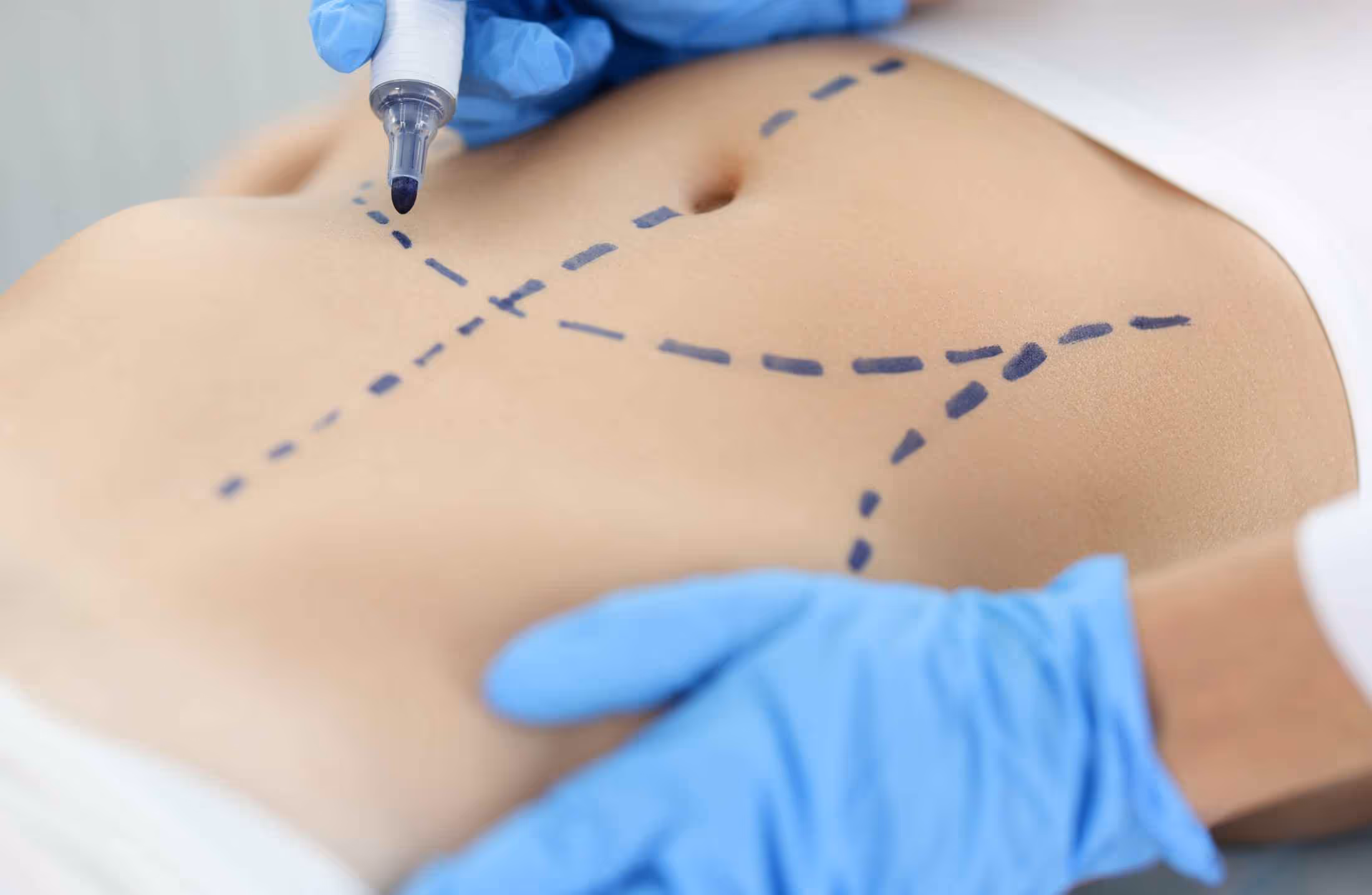 Conheça a história da cirurgia plástica no Brasil e no mundo