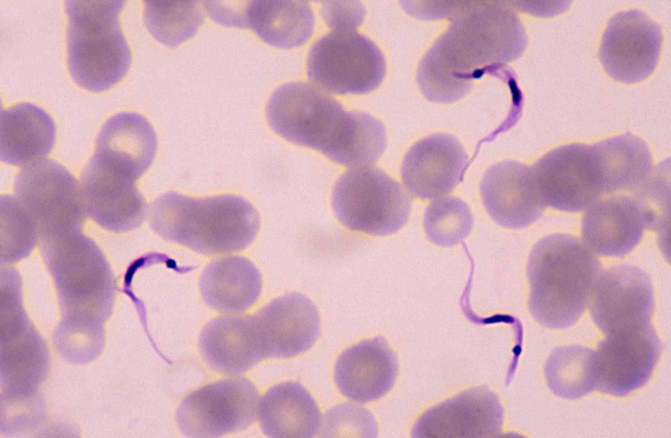 Doença de chagas: tire todas as suas dúvidas