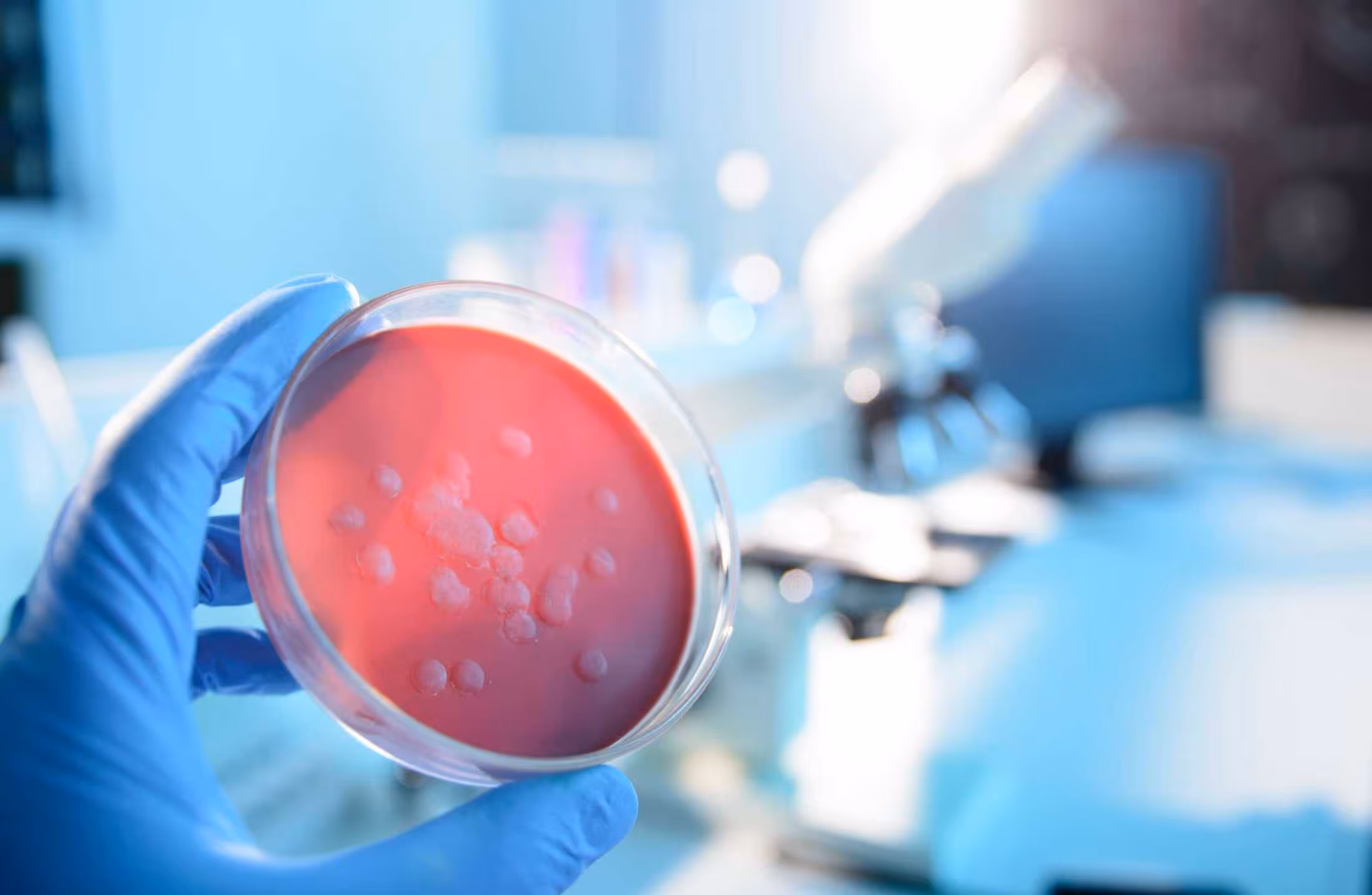 Ebola e vírus Marburg: entenda as semelhanças entre eles