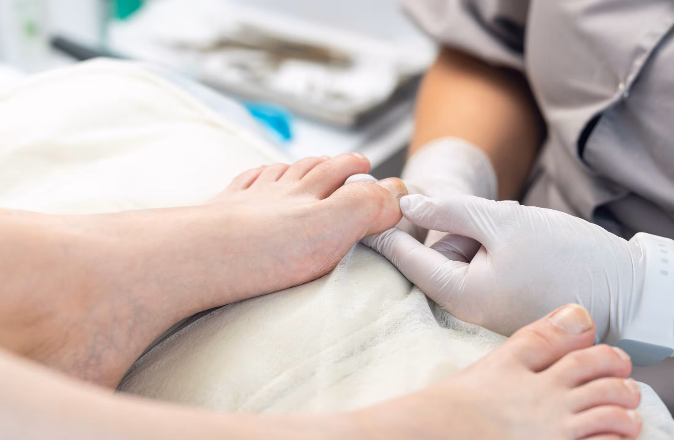 O que são fungos e quais infecções eles podem causar?