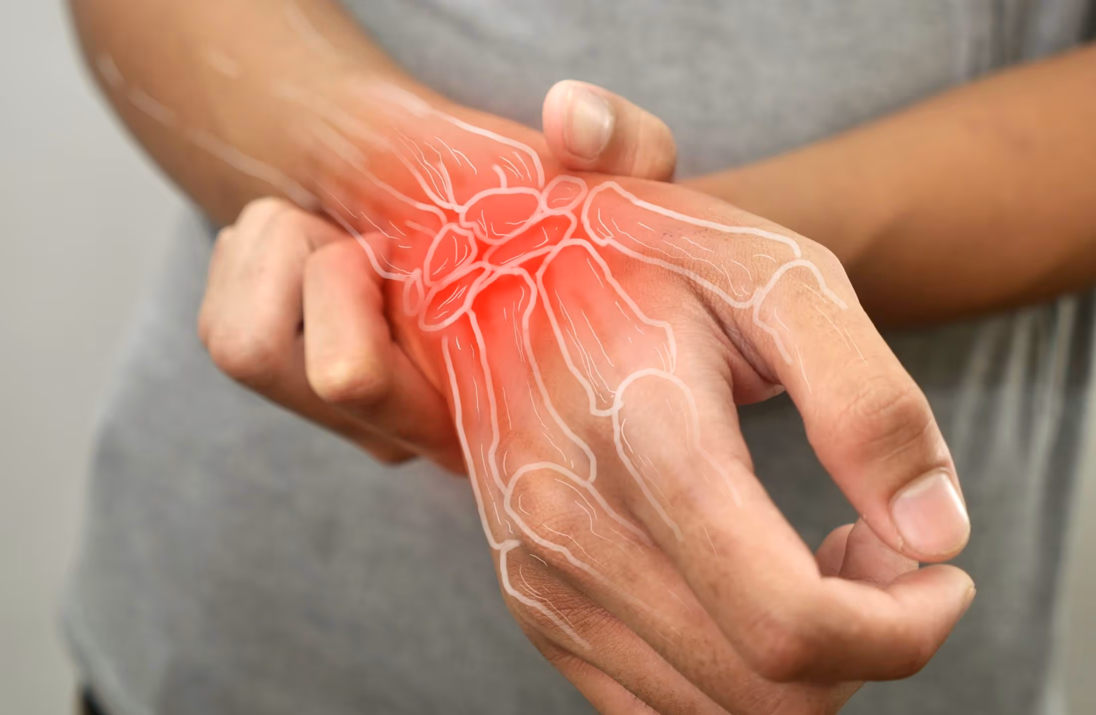 Osteoporose: como prevenir a doença em pacientes mais jovens