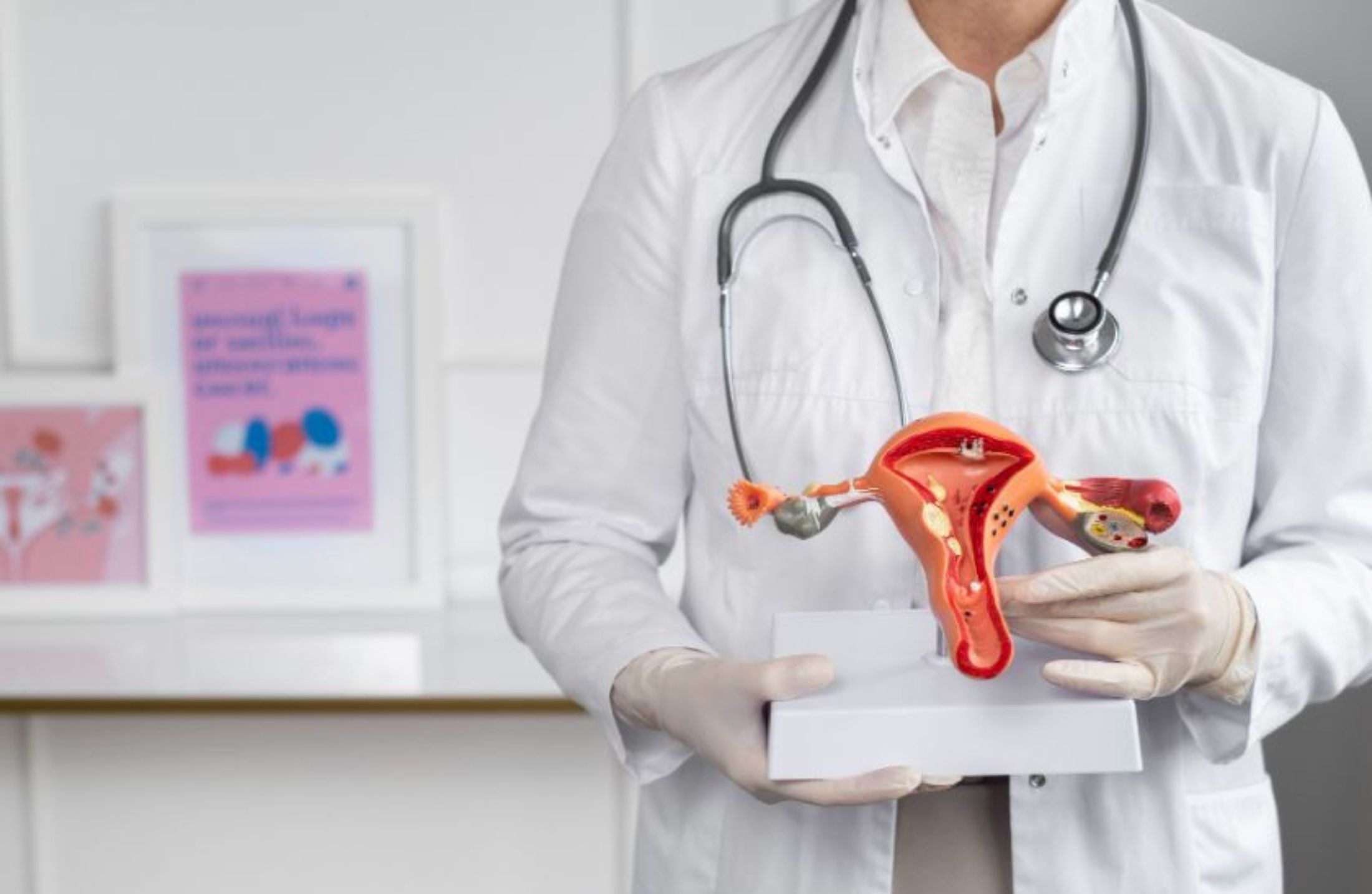 Tudo o que você precisa saber sobre o câncer de colo de útero