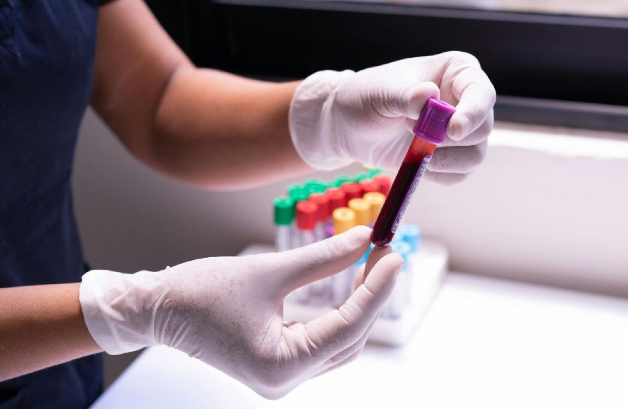 Clamídia: sintomas, riscos e como tratar a infecção