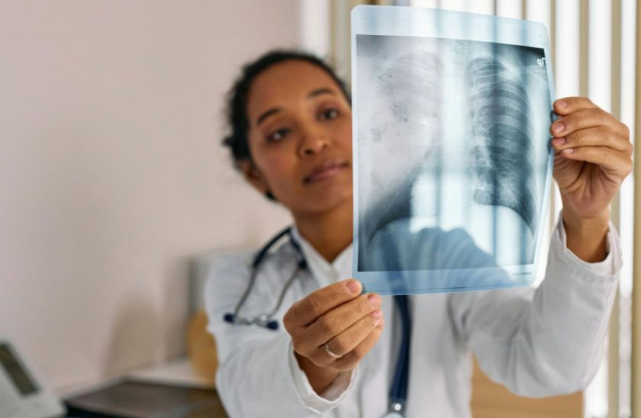 Pneumonia: como identificar os sintomas e quanto tempo leva para curar