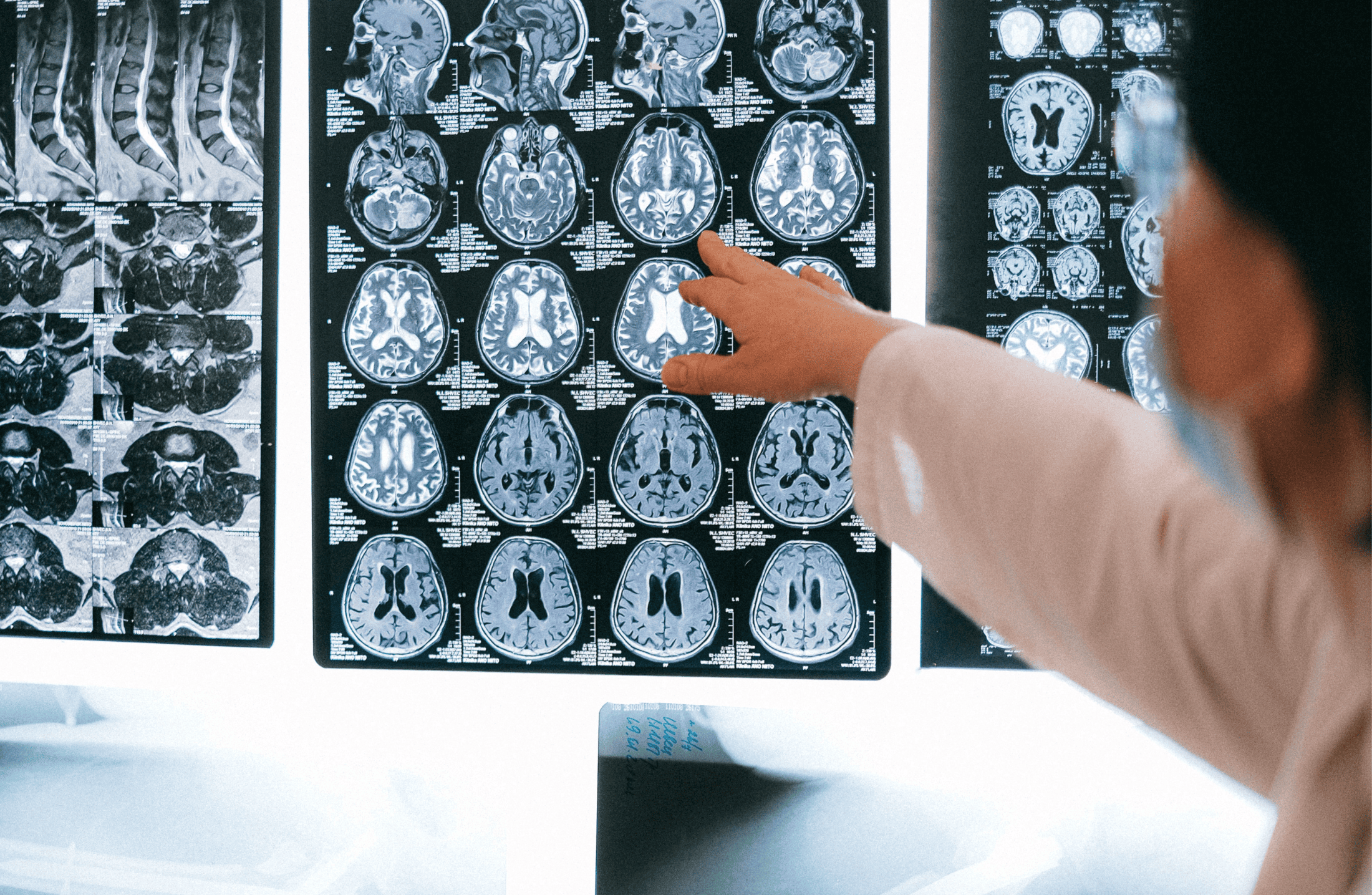Neurofisiologia: entenda o funcionamento do sistema nervoso