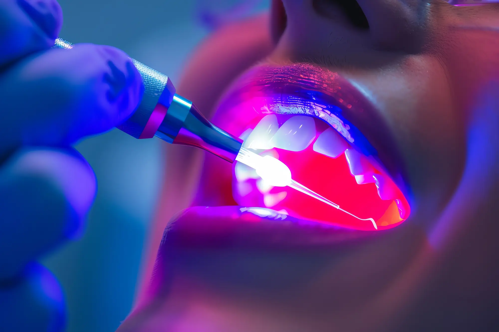 Laser Dentistry vs. Traditional Gum Treatment: What You Need to Know