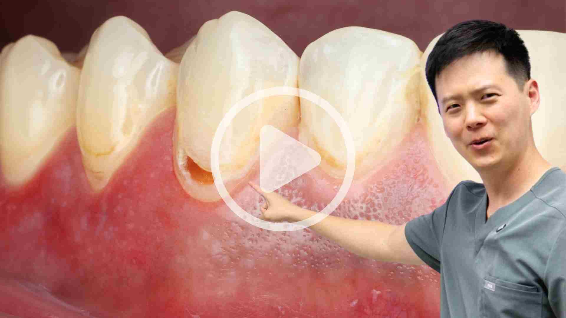 Dental Videos about Common Dental Concerns and Procedures in Washington DC