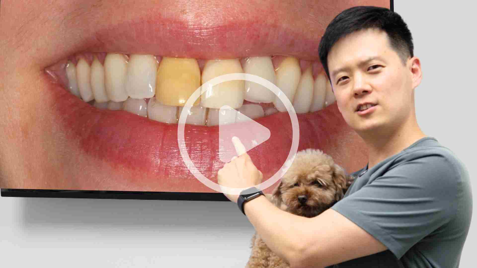 Dental Videos about Common Dental Concerns and Procedures in Washington DC