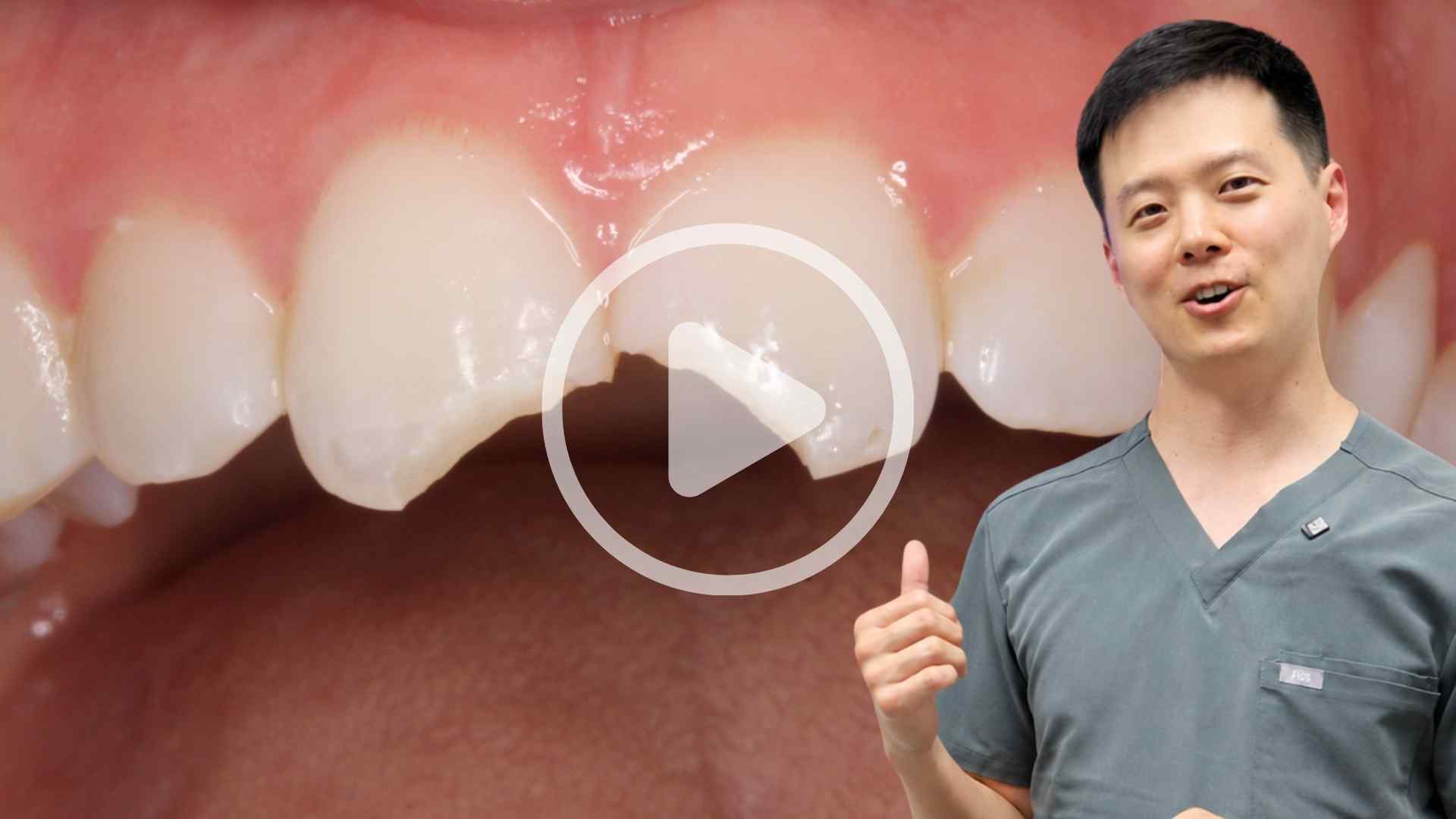 Dental Videos about Common Dental Concerns and Procedures in Washington DC