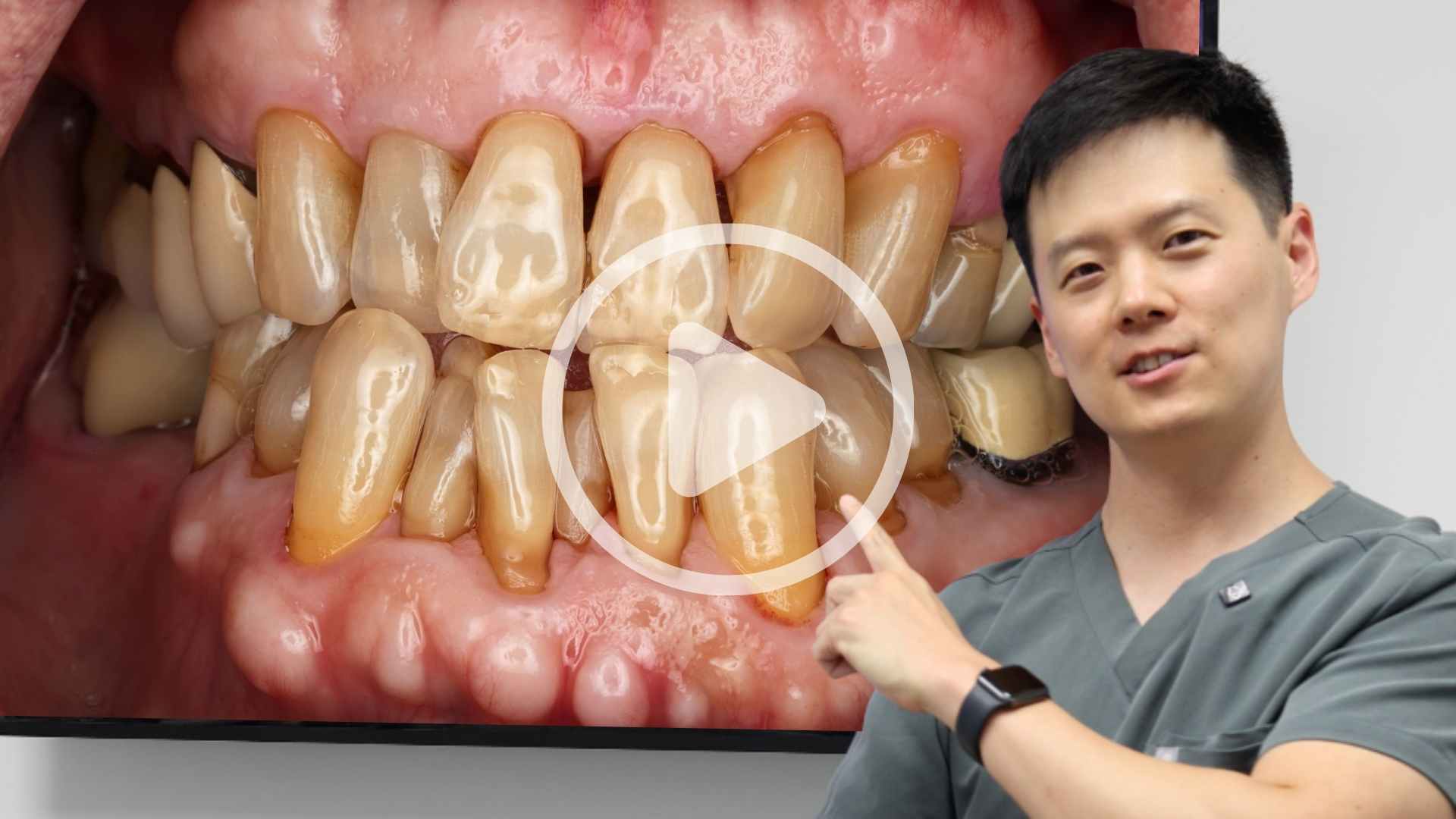 Dental Videos about Common Dental Concerns and Procedures in Washington DC