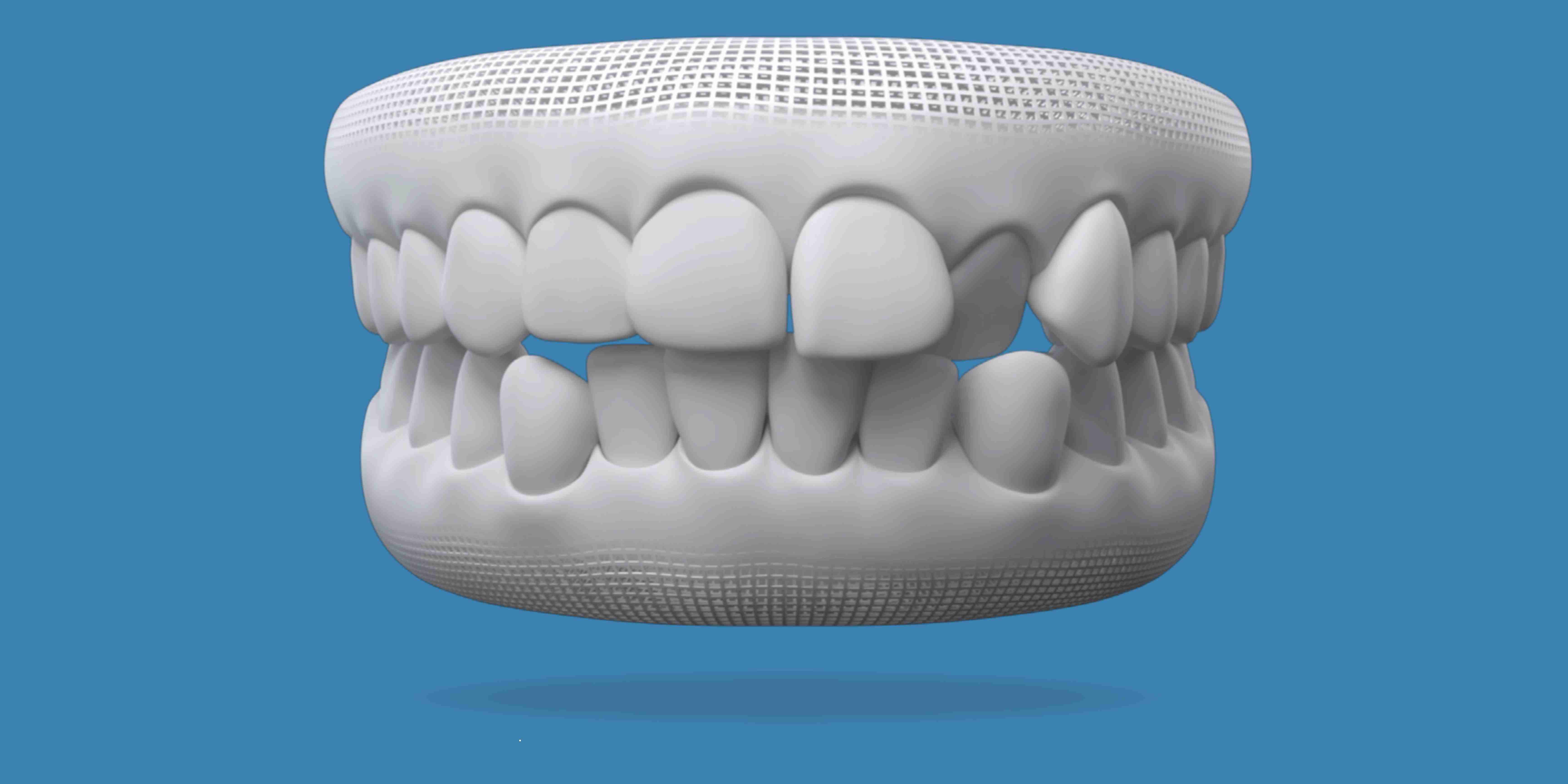 Invisalign for teeth alignment at W Plus Dental in Washington DC