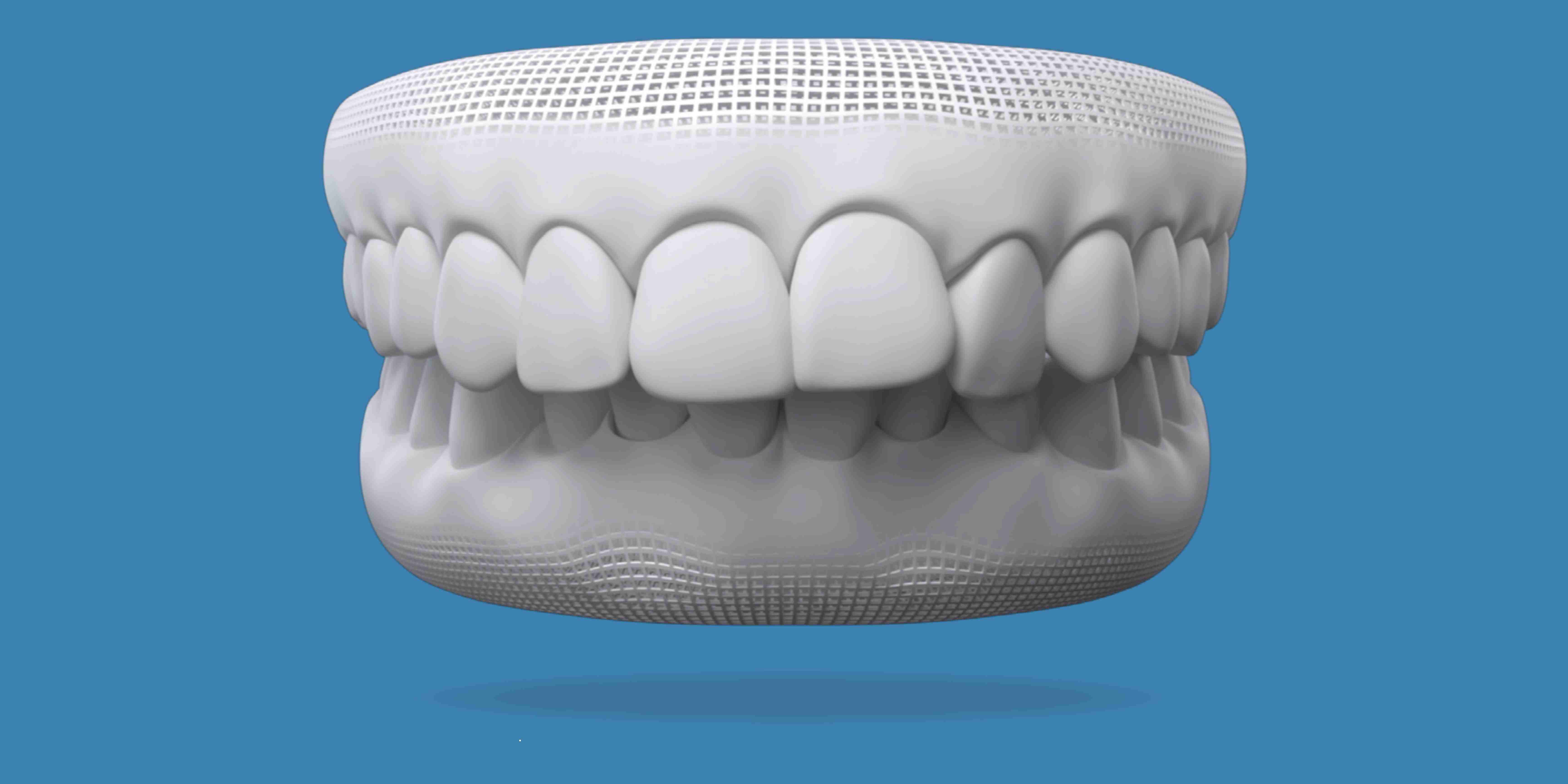 Invisalign for an overbite at W Plus Dental in Washington DC