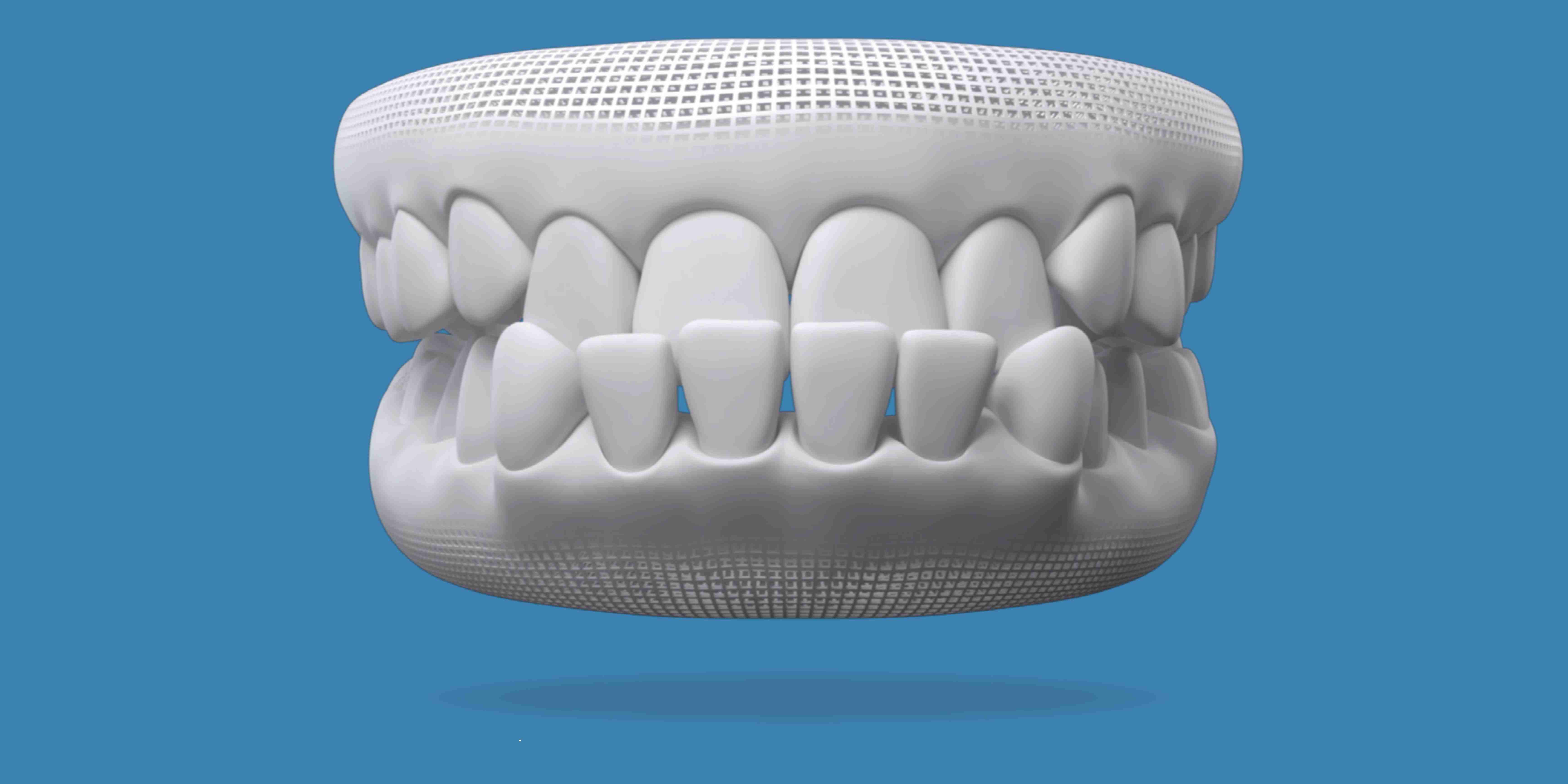 Invisalign for an underbite at W Plus Dental in Washington DC