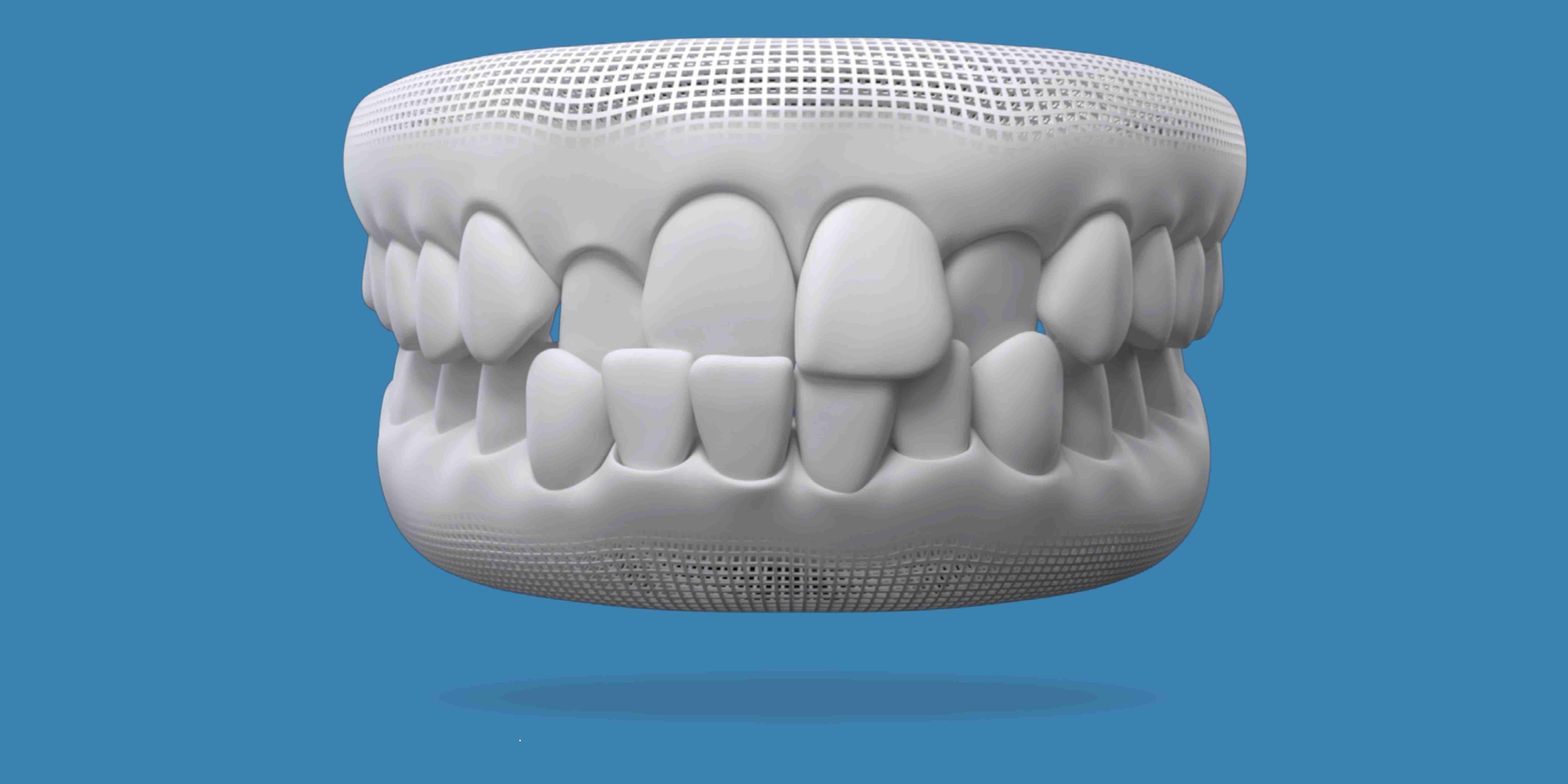 Invisalign for a cross bite  at W Plus Dental in Washington DC