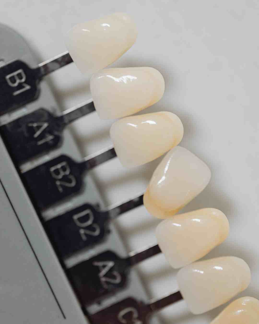 Porcelain Veneers Washington, DC | Smile Makeovers | W Plus Dental