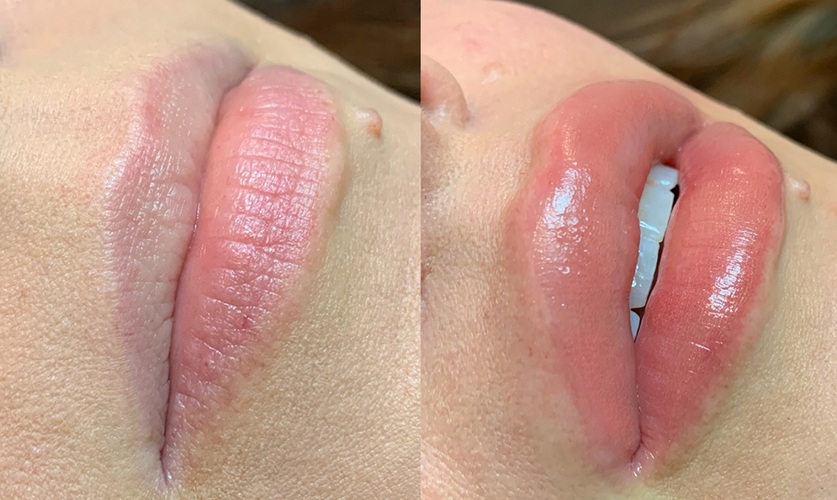 Lip blushing results in Miami FL