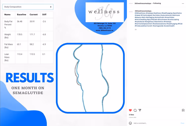 Semaglutide Weight Loss Before and Afters