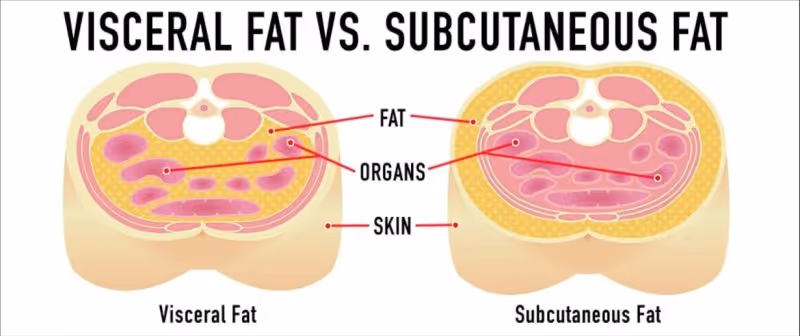 Visceral Fat Measurement