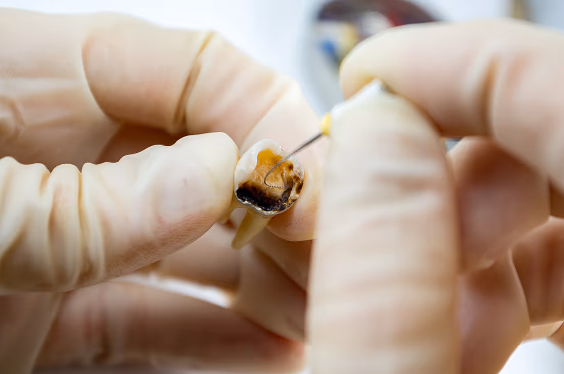 tooth and mirror tool