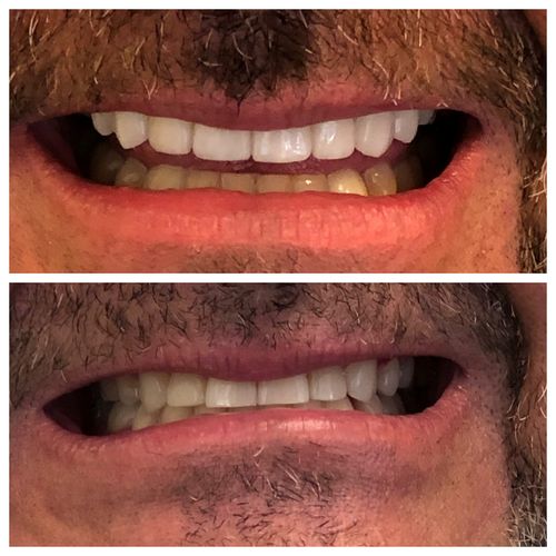 before and after treatment