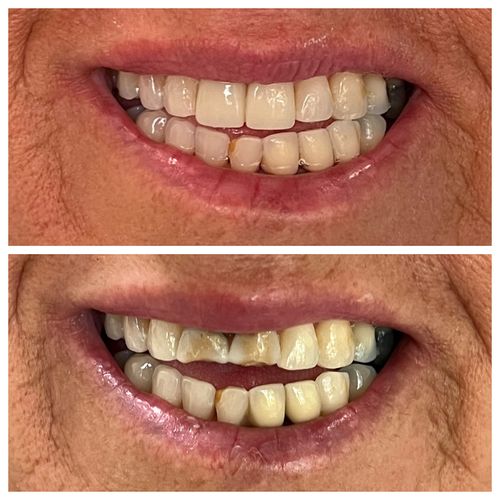 before and after treatment