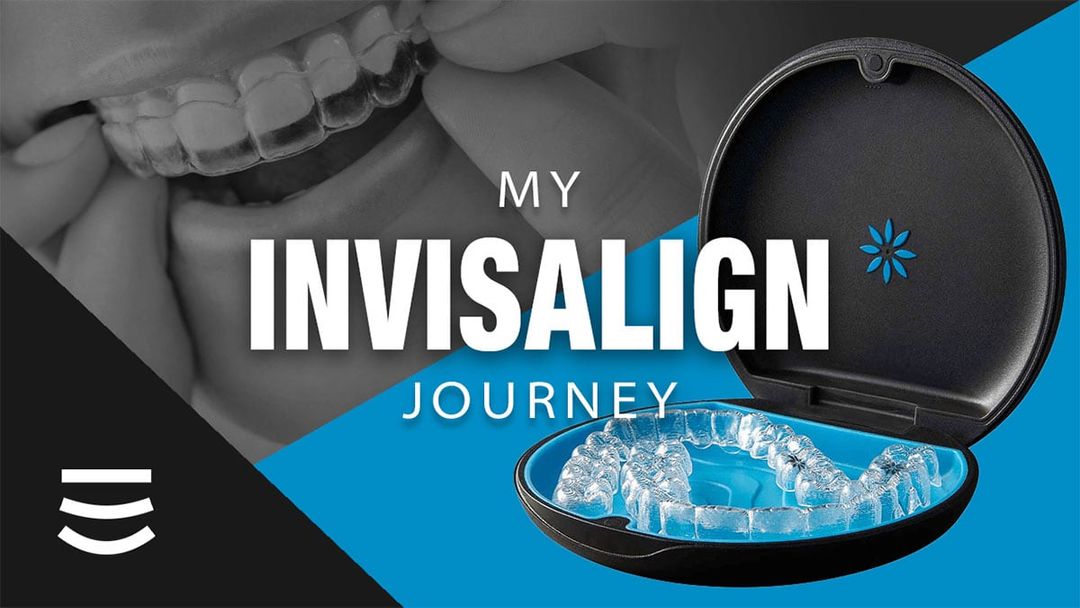 Insights on Invisalign