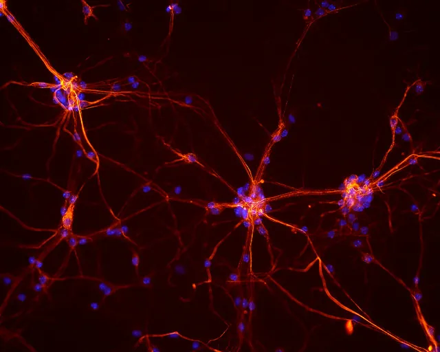 Deep Learning