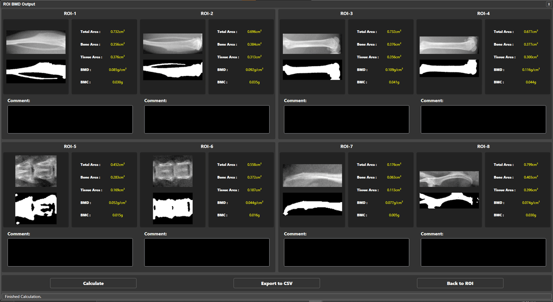 DIGIMUS® multi | Dual-Energy X-ray Absorptiometry (DXA) Dexa Software