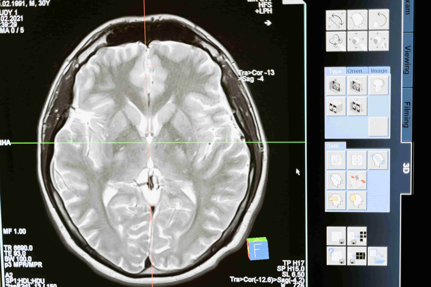 Il cervello tripartito: dagli istinti ai significati