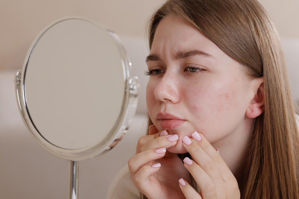 Should My Skin Get Worse Before It Gets Better? 