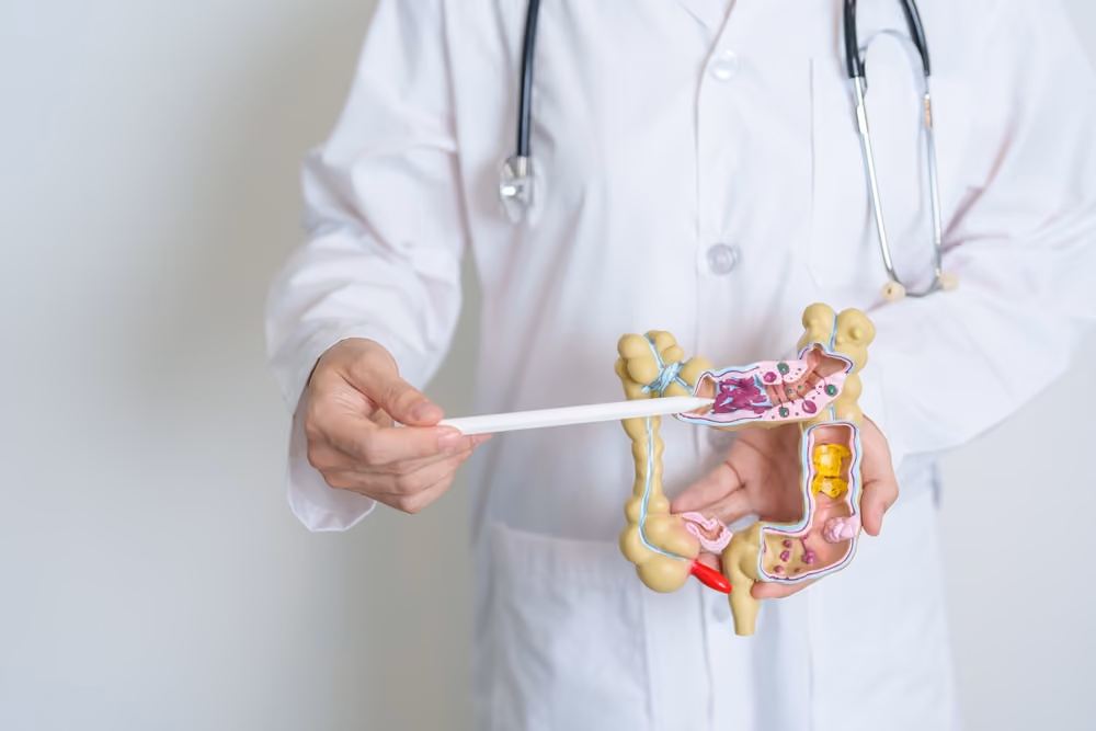 A doctor holding up a model of the human gastrointestinal system.
