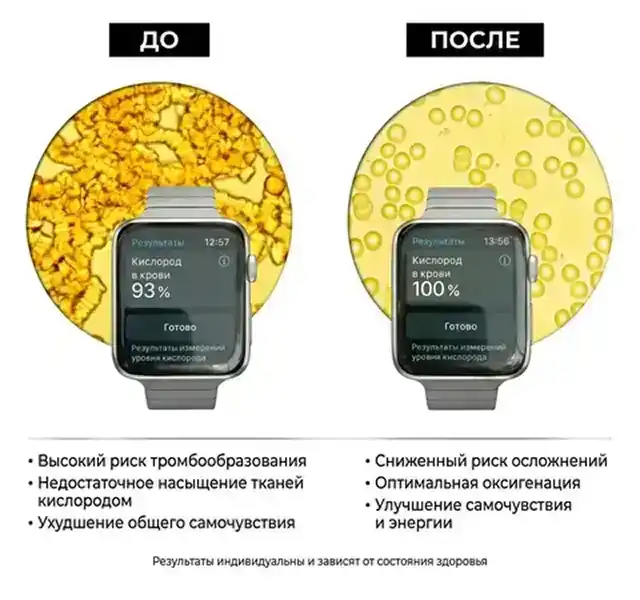 Образцы крови под микроскопом до приёма Синтезита и через час после