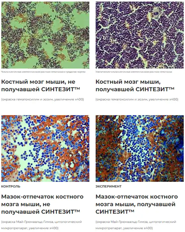 Синтезит увеличивает количество стволовых клеток в костном мозге в 2,5 раза