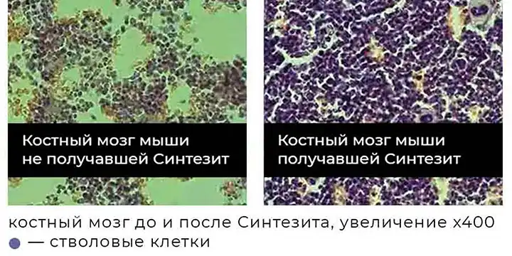 Изображение, полученное под микроскопом, показывает как увеличилось количество стволовых клеток в костном мозге потребителей минерала Синтезит