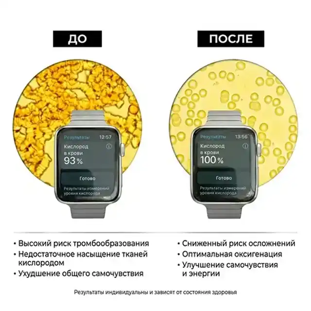 Наглядный эффект, который оказывает минерал Синтезит на кровь