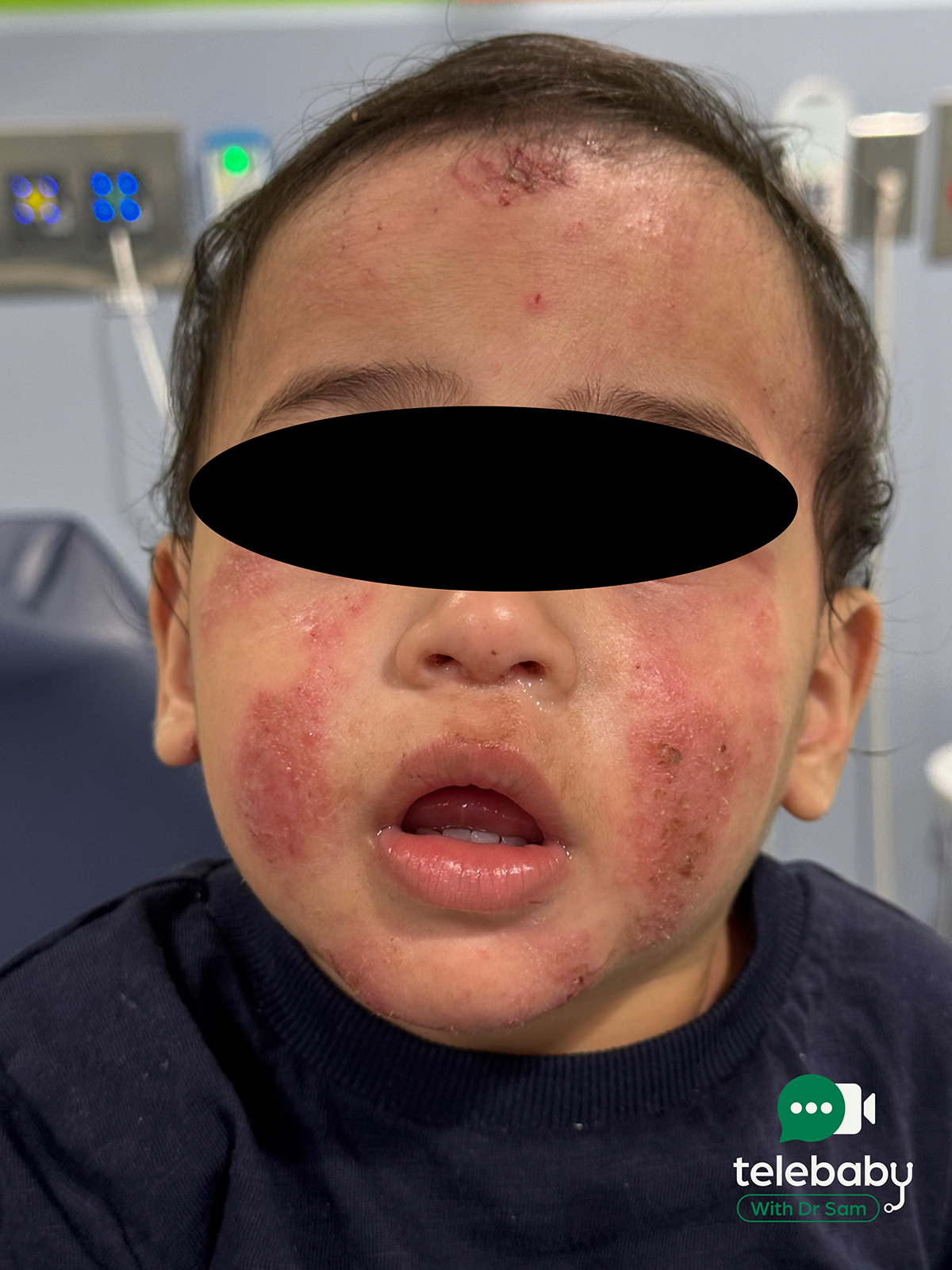 How to Treat Eczema in Babies and Children: A Paediatrician’s Guide