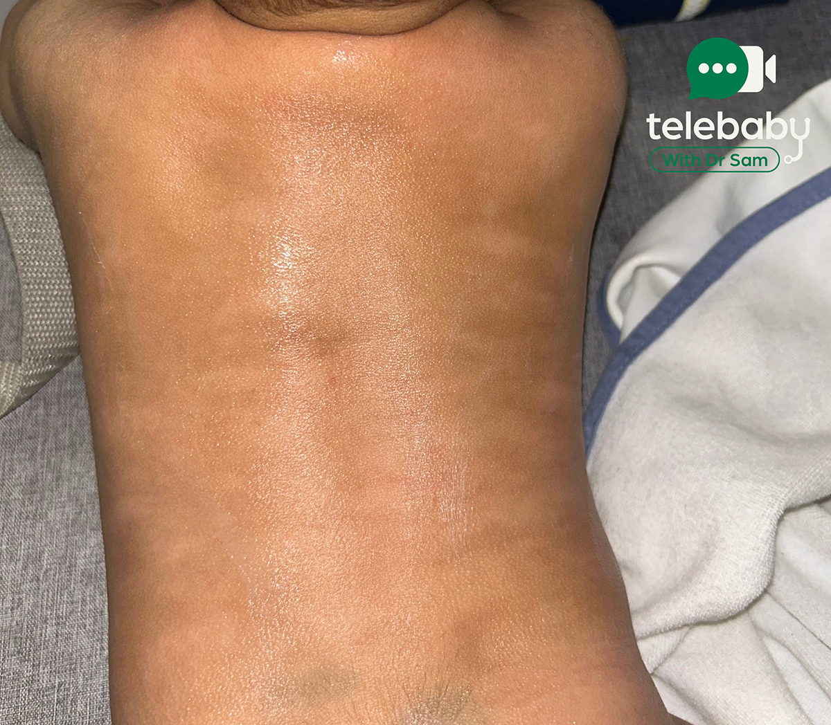 How to Treat Eczema in Babies and Children: A Paediatrician’s Guide