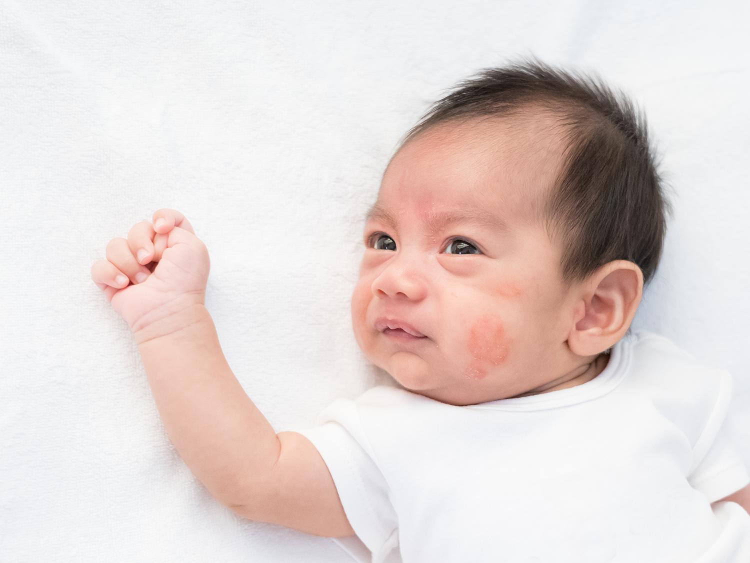How to Treat Eczema in Babies and Children: A Paediatrician's Guide