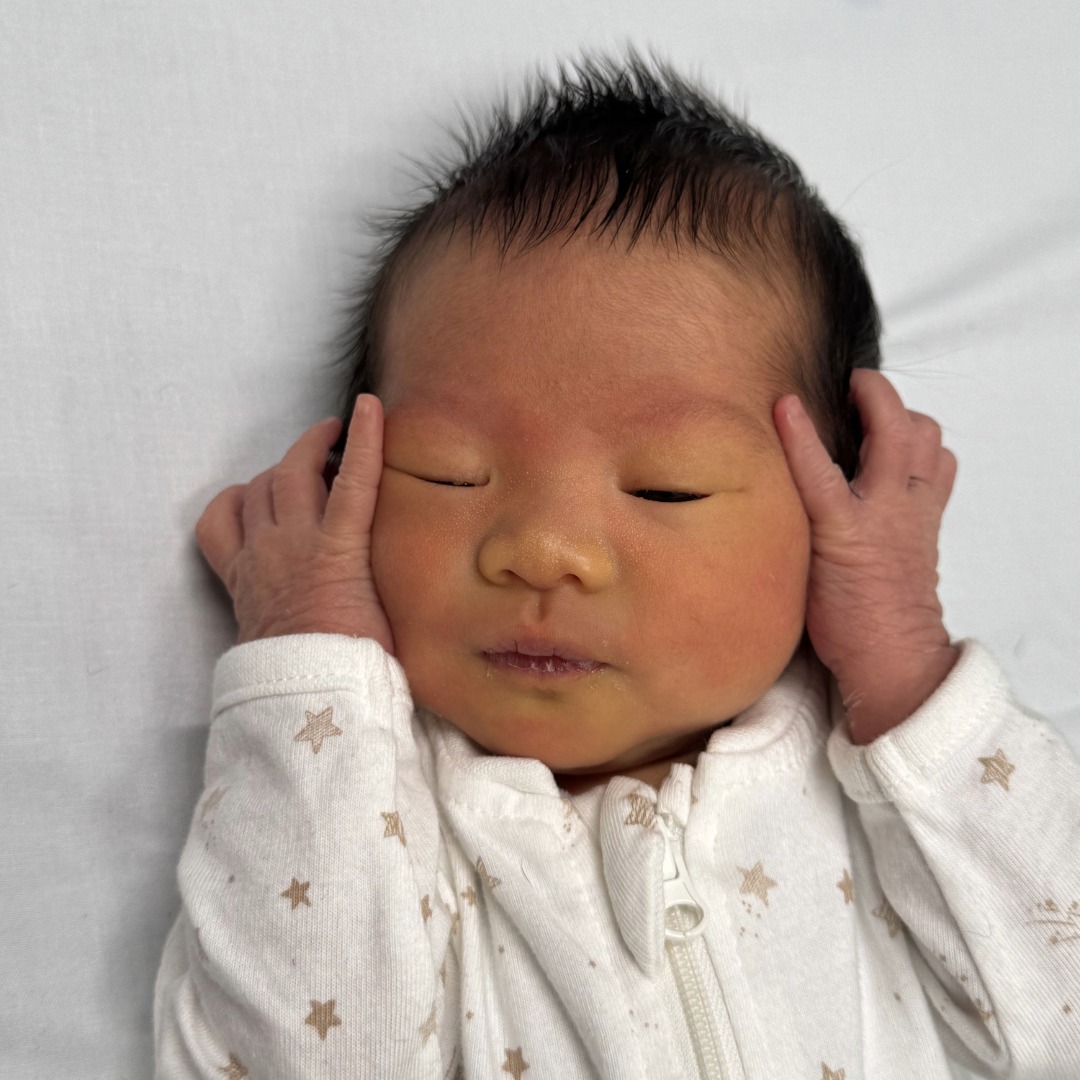 Newborn Jaundice Explained: Symptoms, Causes and Treatment