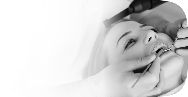 Genel Diş Tedavileri