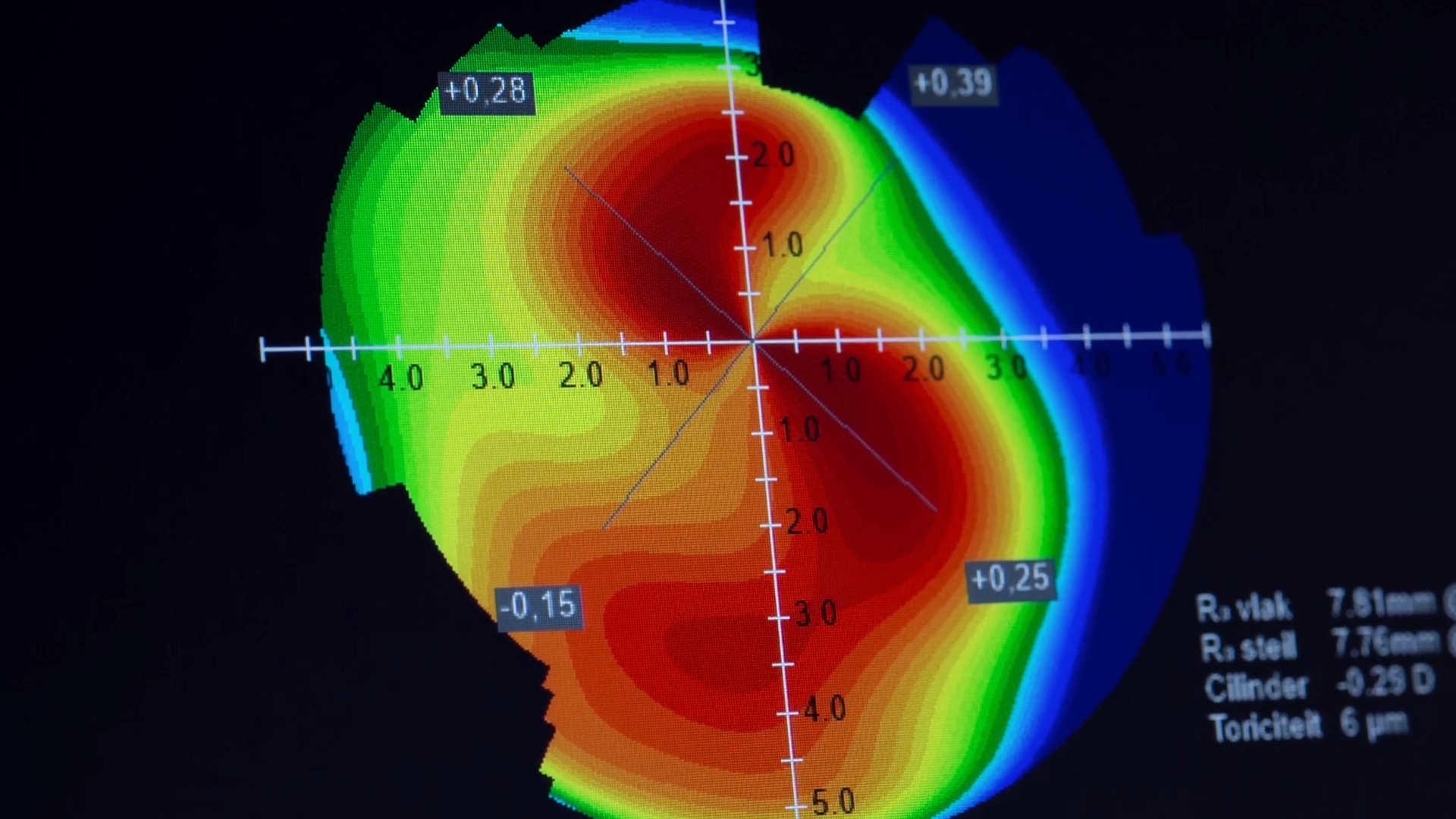 3D rendering of a neural synapse showing an axon terminal with neurotransmitter vesicles and synaptic cleft.